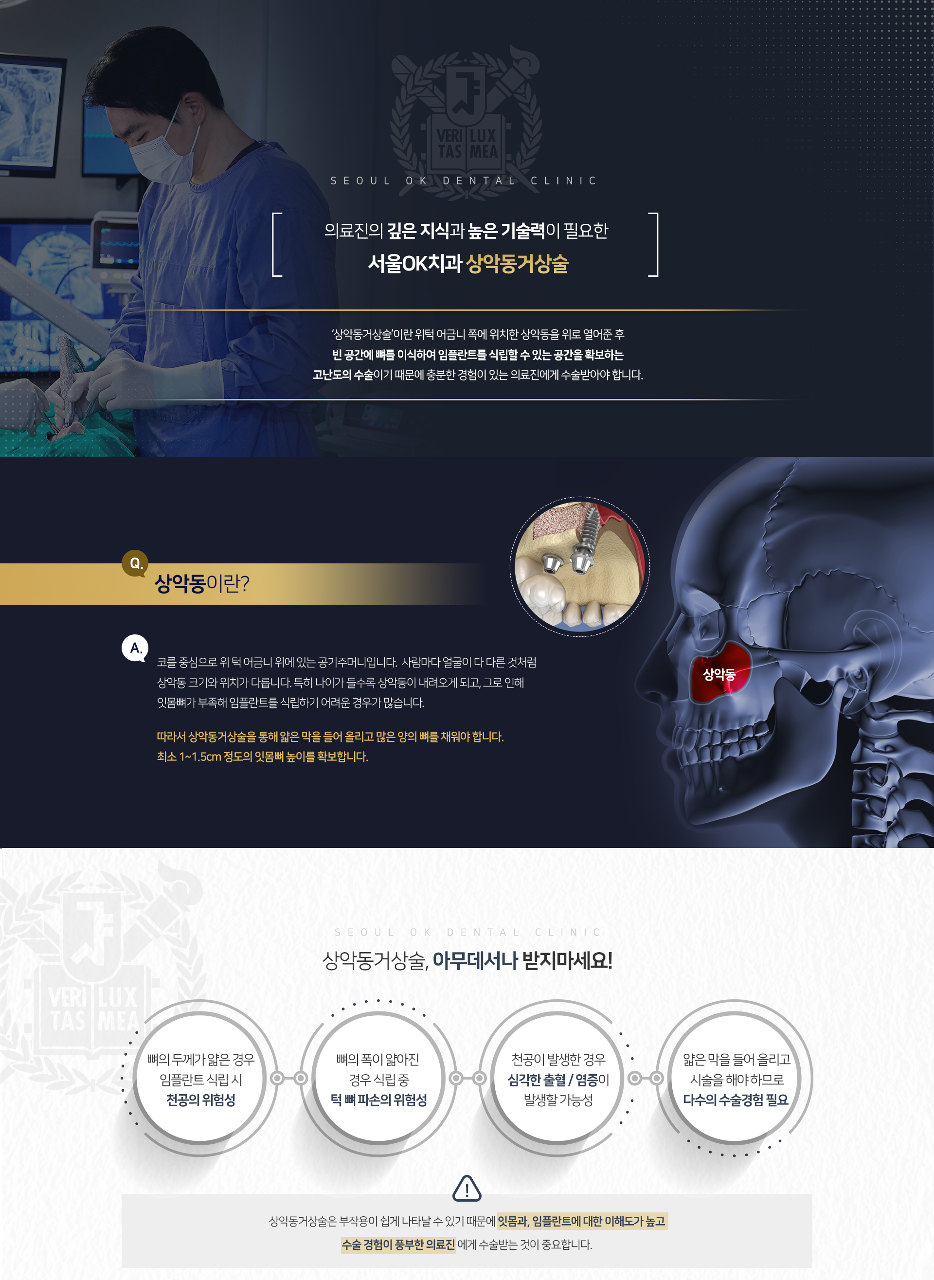 상악동거상술이란-위턱-어금니-쪽에-위치한-상악동을-위로-열어준-후-빈-공간에-뼈를-이식하여-임플란트를-식립할-수-있는-공간을-확보하는-고난도의-수술이기-때문에-충분한-경험이-있는-의료진에게-수술받아야-합니다