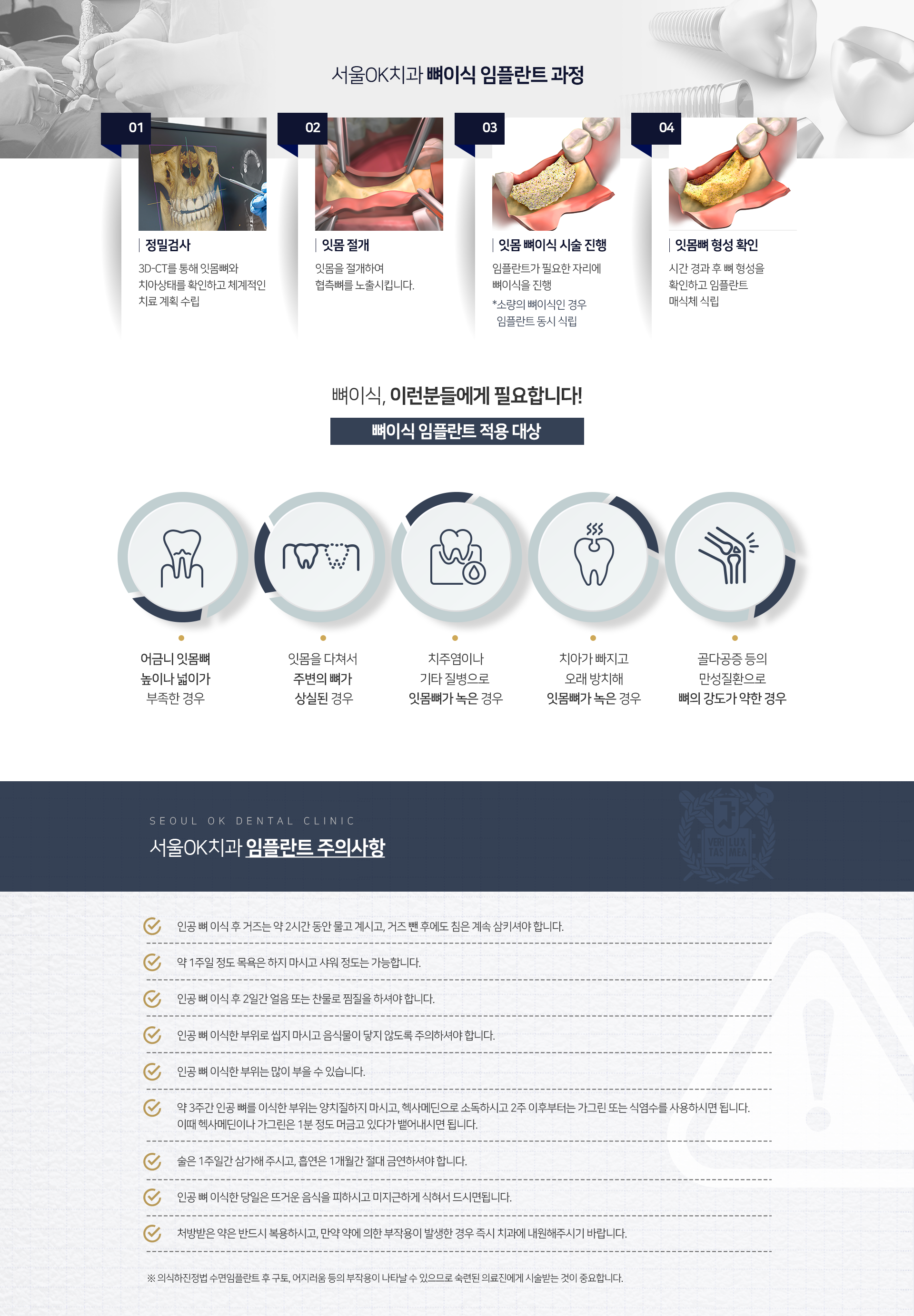 적용-대상-어금니-잇몸뼈-높이나-넓이가-부족한-경우-잇몸을-다쳐서-주변의-뼈가-상실된-경우-치주염이나-기타-질병으로-잇몸뼈가-녹은-경우-치아가-빠지고-오래-방치해-잇몸뼈가-녹은-경우-골다공증-등의-만성질환으로-뼈의-강도가-약한-경우-주의사항-인공-뼈-이식-후-거즈는-약-2시간-동안-물고-계시고-거즈-뺀-후에도-침은-계속-삼키셔야-합니다-약-1주일-정도-목욕은-하지-마시고-샤워-정도는-가능합니다-인공-뼈-이식-후-2일간-얼음-또는-찬물로-찜질을-하셔야-합니다-인공-뼈-이식한-부위로-씹지-마시고-음식물이-닿지-않도록-주의하셔야-합니다-인공-뼈-이식한-부위는-많이-부을-수-있습니다-약-3주간-인공-뼈를-이식한-부위는-양치질하지-마시고-헥사메딘으로-소독하시고-2주-이후부터는-가그린-또는-식염수를-사용하시면-됩니다-이때-헥사메딘이나-가그린은-1분-정도-머금고-있다가-뱉어내시면-됩니다-술은-1주일간-삼가해-주시고-흡연은-1개월간-절대-금연하셔야-합니다-인공-뼈-이식한-당일은-뜨거운-음식을-피하시고-미지근하게-식혀서-드시면-됩니다-처방받은-약은-반드시-복용하시고-만약-약에-의한-부작용이-발생한-경우-즉시-치과에-내원해주시기-바랍니다-의식하진정법 수면임플란트-후-구토,-어지러움-등의-부작용이-나타날-수-있으므로-숙련된-의료진에게-시술받는-것이-중요합니다