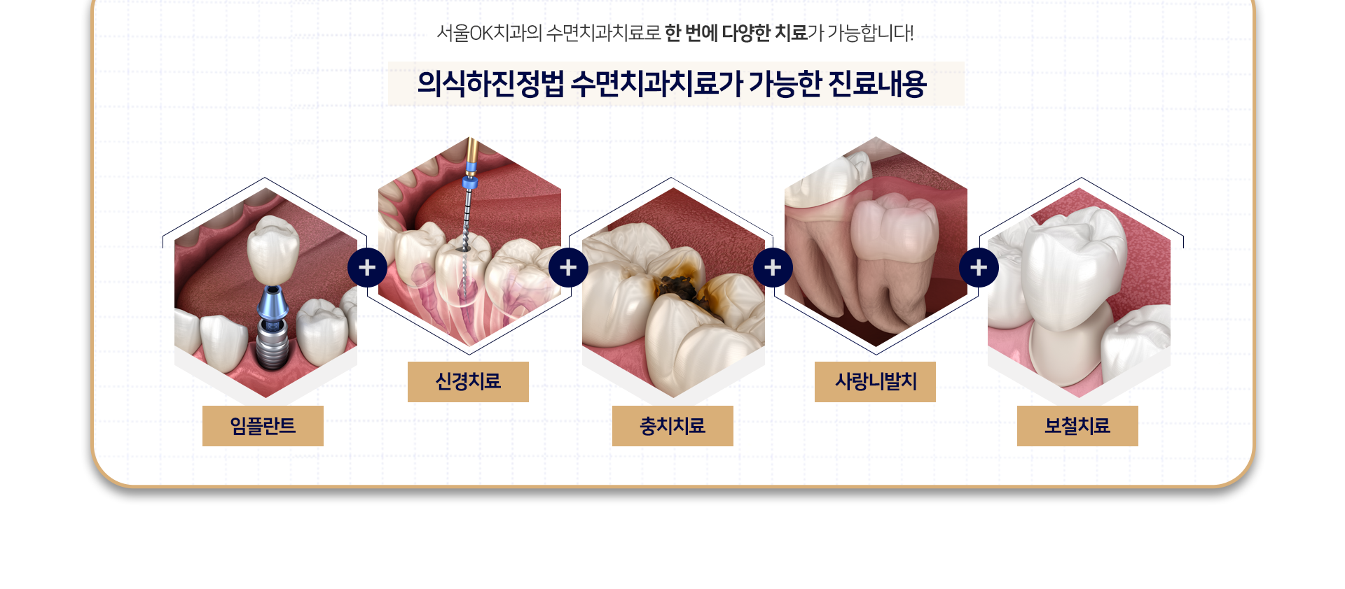 수면치과치료로-한번에-다양한-치료가-가능합니다-수면치과치료가-가능한-진료과목-임플란트,-신경치료,-충치치료,-사랑니발치,-보철치료