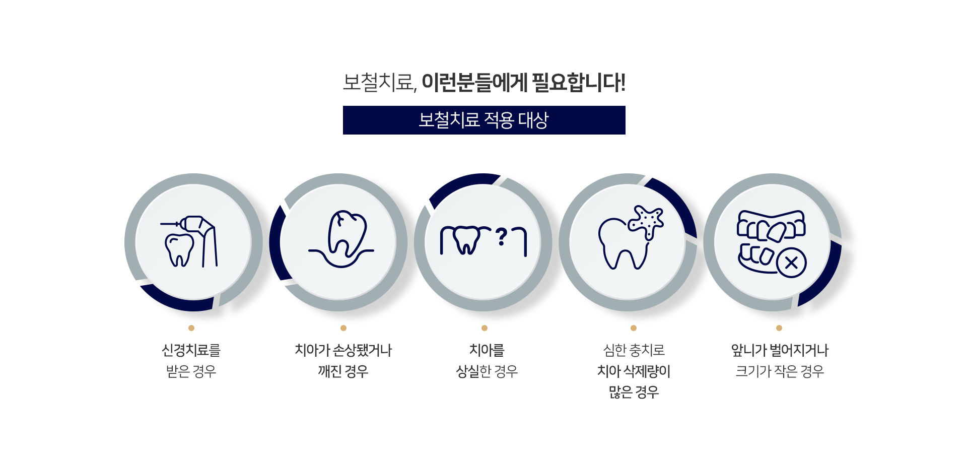 적용-대상-신경치료를-받은-경우-치아가-손상됐거나-깨진-경우-치아를-상실한-경우-심한-충치로-치아-삭제량이-많은-경우-앞니가-벌어지거나-크기가-작은-경우