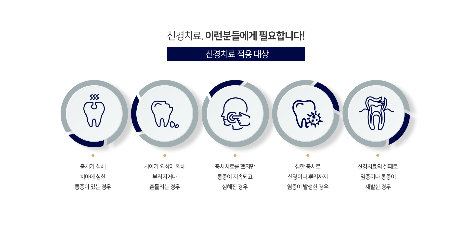 적용-대상-충치가-심해-치아에-심한-통증이-있는-경우-치아가-외상에-의해-부러지거나-흔들리는-경우-충치치료를-했지만-통증이-지속되고-심해진-경우-심한-충치로-신경이나-뿌리까지-염증이-발생한-경우-신경치료의-실패로-염증이나-통증이-재발한-경우