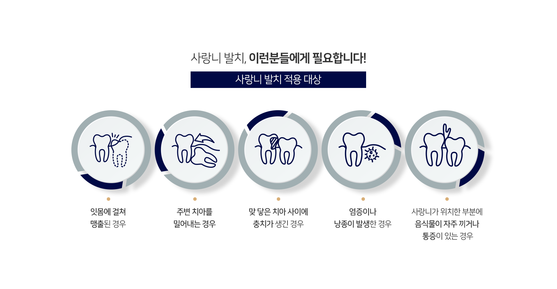 적용-대상-잇몸에-걸쳐-맹출-된-경우-주변-치아를-밀어내는-경우-맞닿은-치아-사이에-충치가-생긴-경우-염증이나-낭종이-발생한-경우-사랑니가-위치한-부분에-음식물이-자주-끼거나-통증이-있는-경우