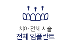 전체임플란트