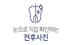 전후사진