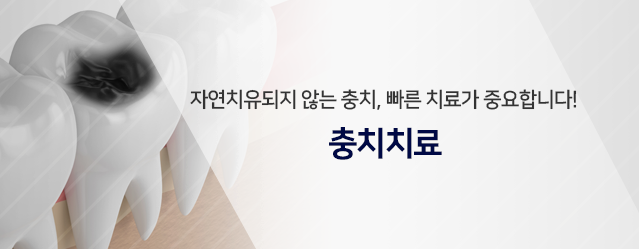 자연치유되지-않는-충치,-빠른-치료가-중요합니다-충치치료