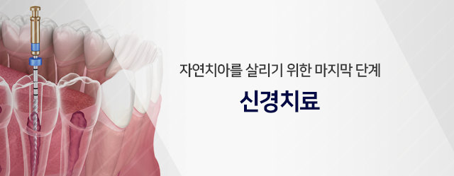 자연치아를-살리기-위한-마지막-단계-신경치료