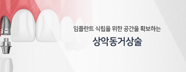 임플란트-식립을-위한-공간을-확보하는-상악동거상술