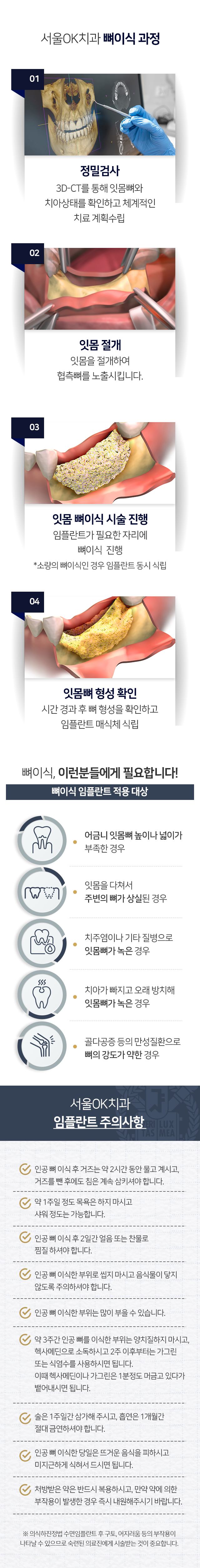 뼈이식-임플란트-과정-1단계-정밀검사-3D_CT를-통해-잇몸뼈와-치아상태를-확인하고-체계적인-치료-계획-수립-2단계-잇몸-절개-잇몸을-절개하여-협측뼈를-노출시킵니다-3단계-잇몸-뼈이식-시술-진행-임플란트가-필요한-자리에-뼈이식을-진행-소량의-뼈이식인-경우-임플란트-동시-식립-4단계-잇몸뼈-형성-확인-시간-경과-후-뼈-형성을-확인하고-임플란트-매식체-식립-적용-대상-어금니-잇몸뼈-높이나-넓이가-부족한-경우-잇몸을-다쳐서-주변의-뼈가-상실된-경우-치주염이나-기타-질병으로-잇몸뼈가-녹은-경우-치아가-빠지고-오래-방치해-잇몸뼈가-녹은-경우-골다공증-등의-만성질환으로-뼈의-강도가-약한-경우-주의사항-인공-뼈-이식-후-거즈는-약-2시간-동안-물고-계시고-거즈-뺀-후에도-침은-계속-삼키셔야-합니다-약-1주일-정도-목욕은-하지-마시고-샤워-정도는-가능합니다-인공-뼈-이식-후-2일간-얼음-또는-찬물로-찜질을-하셔야-합니다-인공-뼈-이식한-부위로-씹지-마시고-음식물이-닿지-않도록-주의하셔야-합니다-인공-뼈-이식한-부위는-많이-부을-수-있습니다-약-3주간-인공-뼈를-이식한-부위는-양치질하지-마시고-헥사메딘으로-소독하시고-2주-이후부터는-가그린-또는-식염수를-사용하시면-됩니다-이때-헥사메딘이나-가그린은-1분-정도-머금고-있다가-뱉어내시면-됩니다-술은-1주일간-삼가해-주시고-흡연은-1개월간-절대-금연하셔야-합니다-인공-뼈-이식한-당일은-뜨거운-음식을-피하시고-미지근하게-식혀서-드시면-됩니다-처방받은-약은-반드시-복용하시고-만약-약에-의한-부작용이-발생한-경우-즉시-치과에-내원해주시기-바랍니다-의식하진정법 수면임플란트-후-구토,-어지러움-등의-부작용이-나타날-수-있으므로-숙련된-의료진에게-시술받는-것이-중요합니다