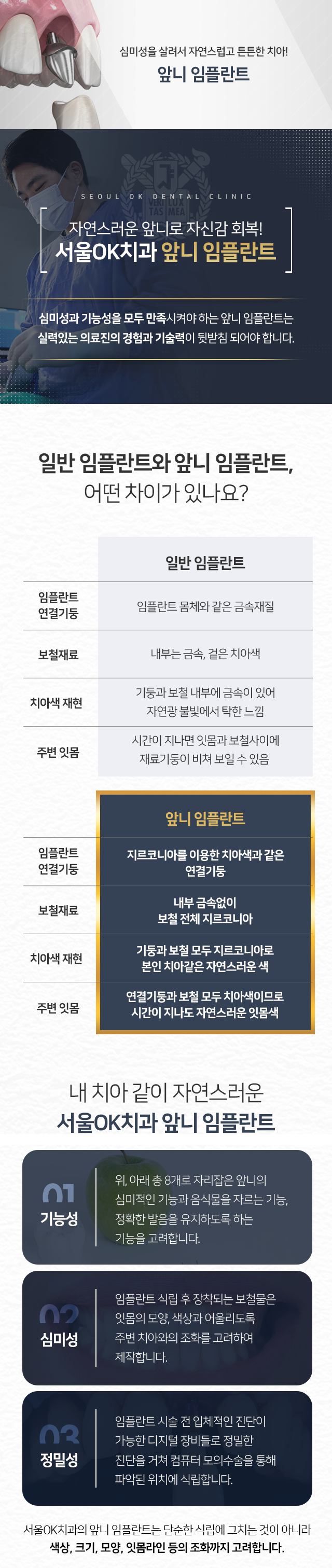 심미성을-살려서-자연스럽고-튼튼한-치아-앞니-임플란트-내-치아같이-자연스러운-앞니-임플란트-특징1-기능성-위,-아래-총-8개로-자리-잡은-앞니의-심미적인-기능과-음식물을-자르는-기능,-정확한-발음을-유지하도록-하는-기능을-고려합니다-특징2-심미성-임플란트-식립-후-장착되는-보철물은-잇몸의-모양,-색상과-어울리도록-주변-치아와의-조화를-고려하여-제작합니다-특징3-정밀성-임플란트-시술-전-입체적인-진단이-가능한-디지털-장비들로-정밀한-진단을-거쳐-컴퓨터-모의수술을-통해-파악된-위치에-식립합니다