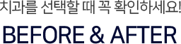 치과를-선택할-때-꼭-확인하세요-BEFORE&AFTER